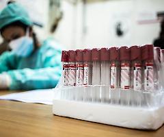 Coronavirus, dal 4 maggio test del sangue su un campione nazionale di 150mila persone