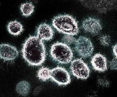 Coronavirus, a Varese scoperto un caso di variante rarissima