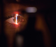 Laser agli occhi: cosa bisogna sapere