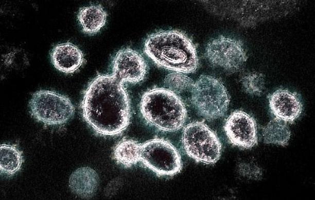 Coronavirus, a Varese scoperto un caso di variante rarissima